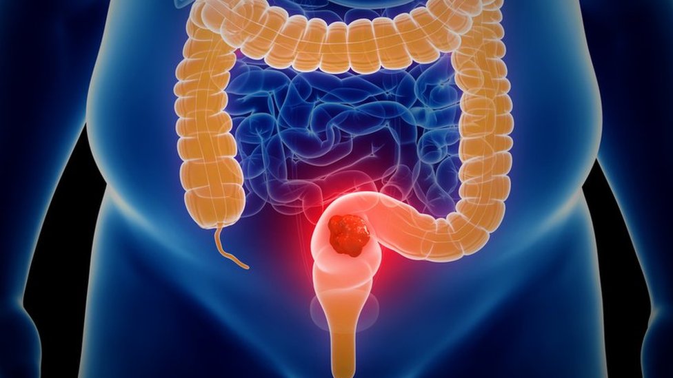 Ilustración del intestino