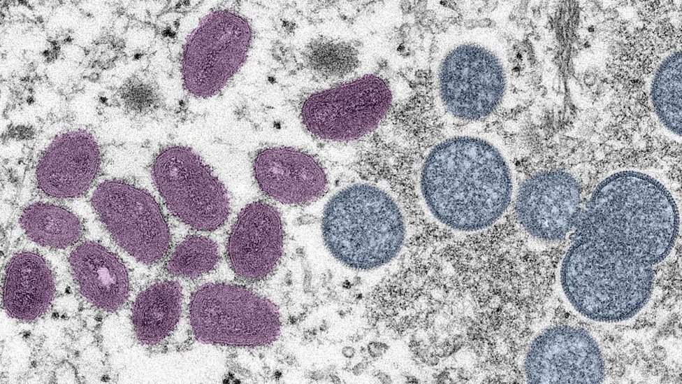 imagen de laboratorio del virus de la viruela del mono.