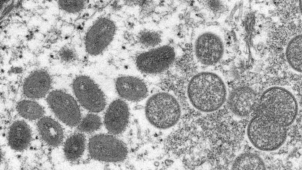 CDC/Reuters La viruela del mono vista bajo un microscopio electrónico.