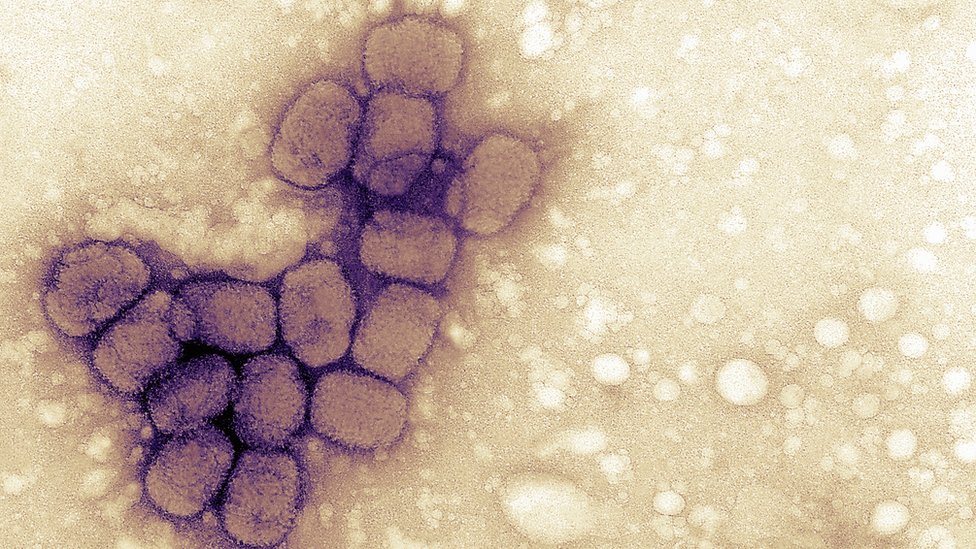 virus de viruela