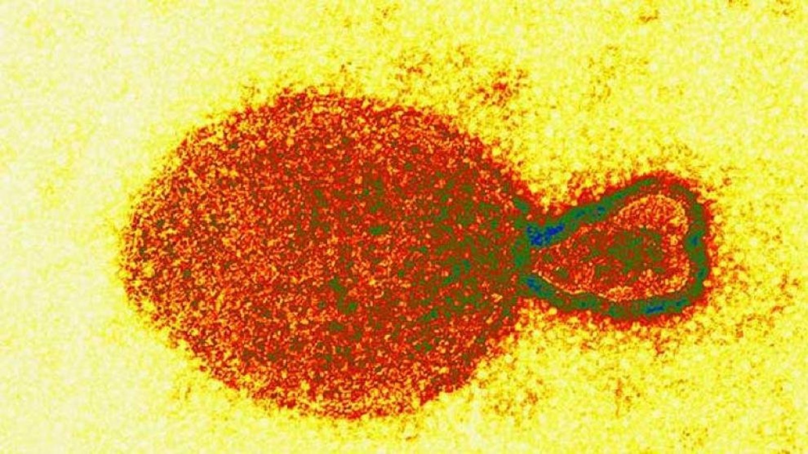 El nuevo virus descubierto en China afectó al menos a 35 personas