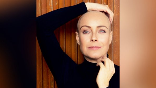 La primera imagen compartida por Claudia Conserva rapada tras haber sido diagnosticada con cáncer de mamas