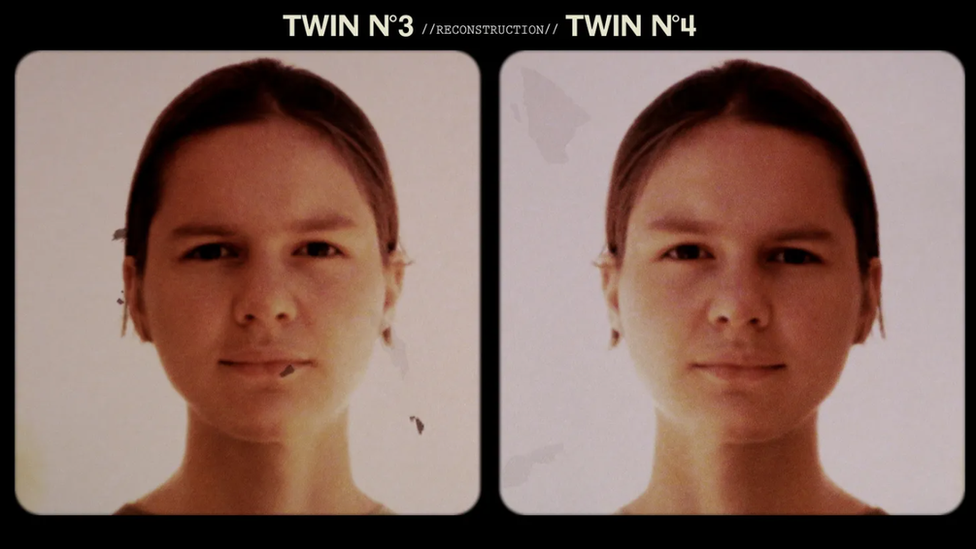 Imagen de hermanas gemelas separadas al nacer tras experimento
