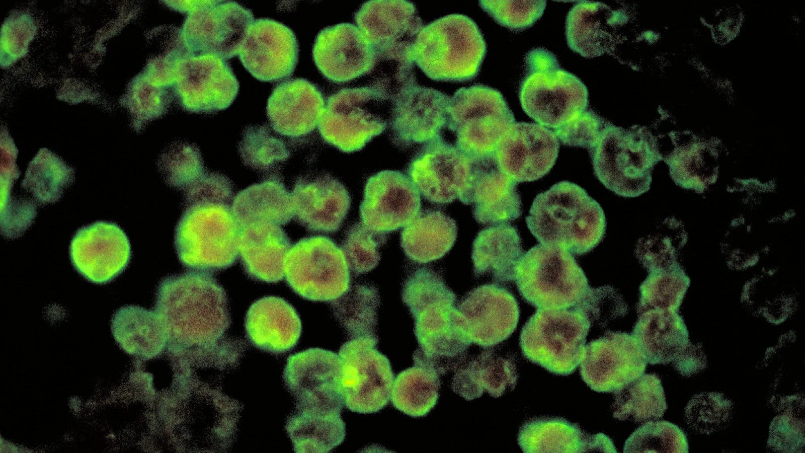 Imagen referencial de una ameba come cerebros