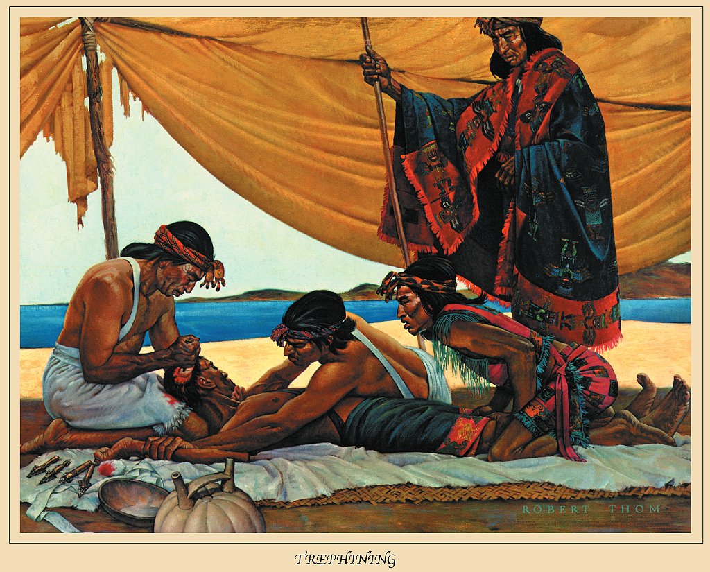 CIRCA 1957: Pintura de una serie realizada para escuelas de historia de la profesión médica.