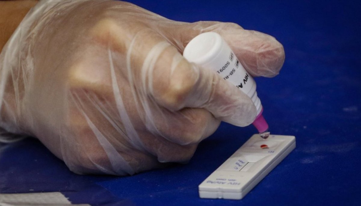 Desde este jueves: realizar test rápidos para detección y prevención del VIH gratis