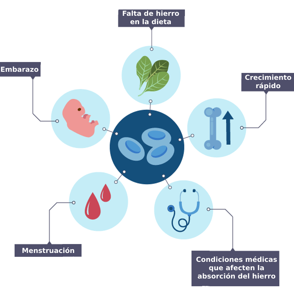 Gráfico que dice: embarazo, menstruación, crecimiento rápido, condiciones médicas que afecten la absorción de hierro, falta de hierro en la dieta