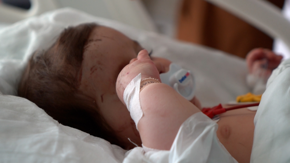 Bebé de seis meses en el hospital de Adana.