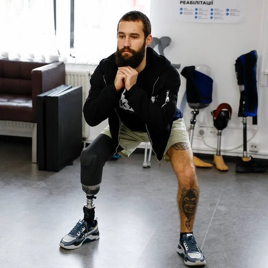 Joven con una prótesis que perdió su pierna por la guerra en Ucrania