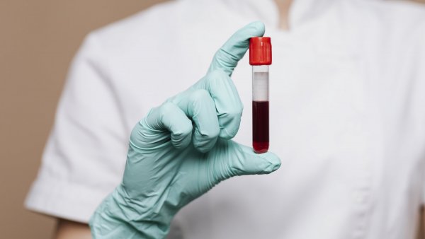 Mano de una enfermera sosteniendo un tubo con sangre.