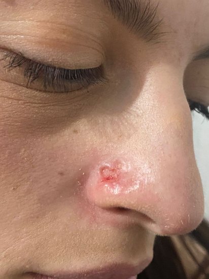 Foto del rostro de Daiane Lima en la que se ve la herida en su nariz.