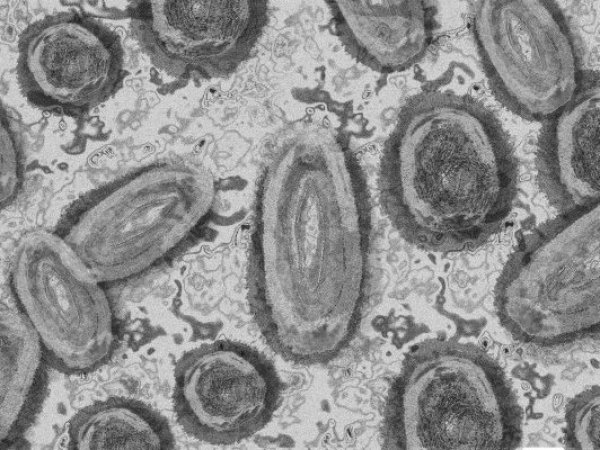 Viruela del mono bajo el microscopio.