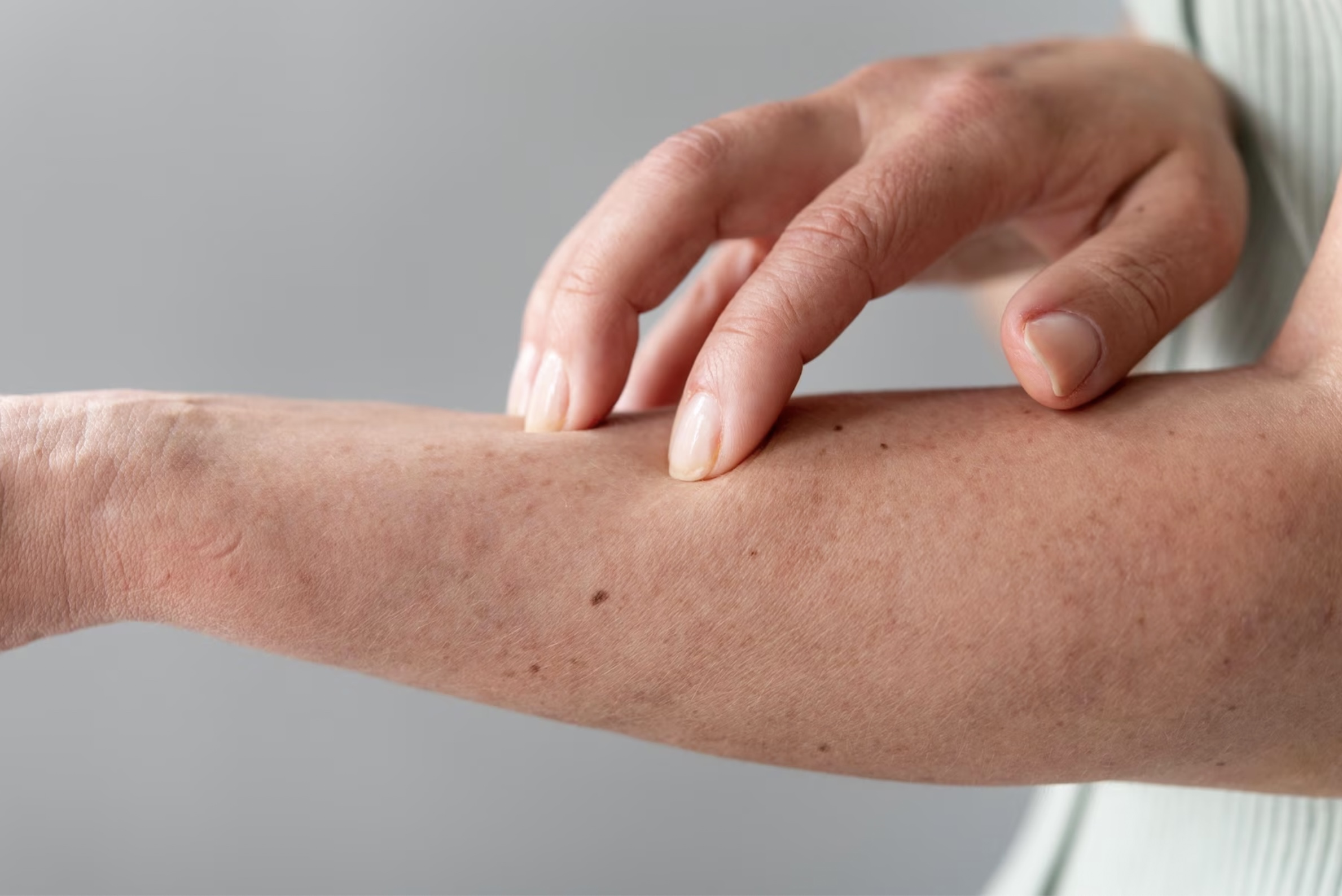Persona tocándose el brazo