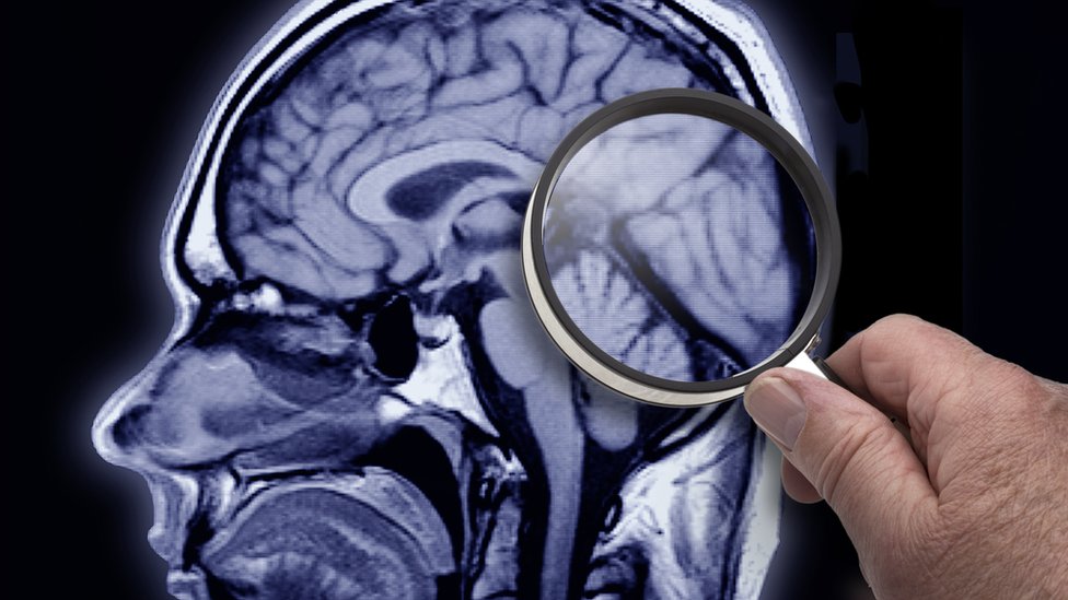 MRI