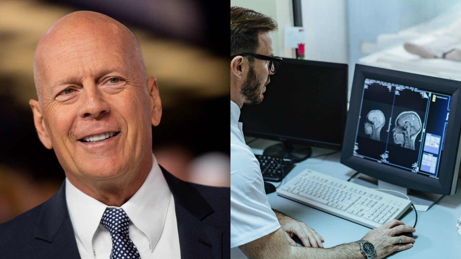 Bruce Willis y resonáncia magnética de cerebro