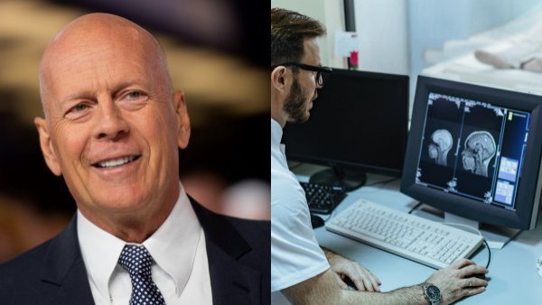 Bruce Willis y resonáncia magnética de cerebro