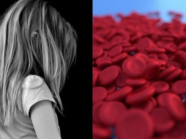 Niña y glóbulos rojos representando una posible anemia.