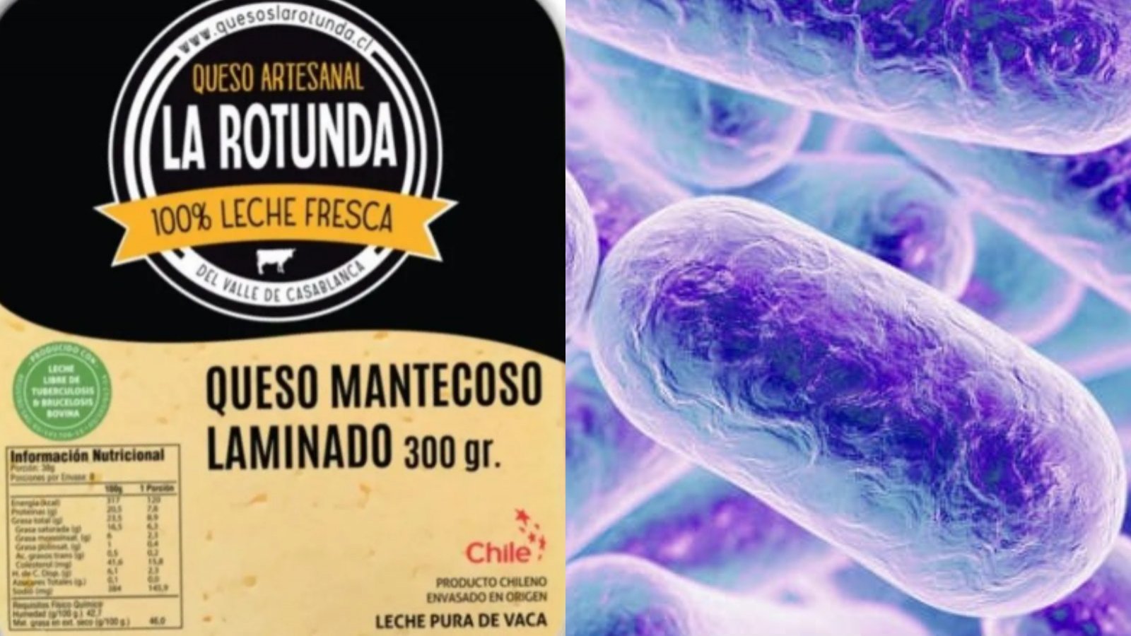 Queso laminado La rotunda y listeria.