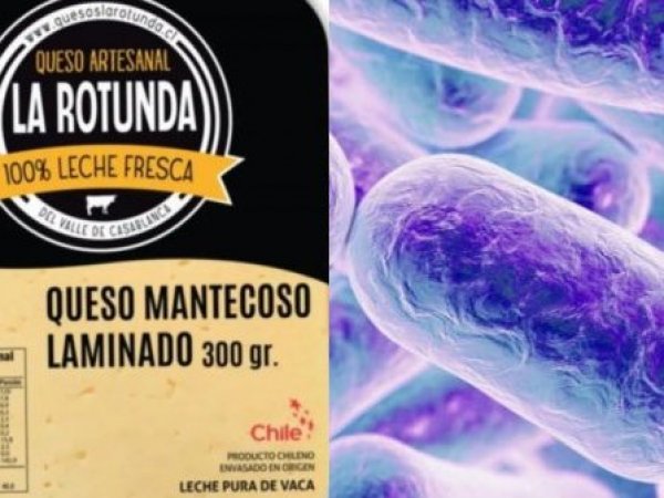 Queso laminado La rotunda y listeria.