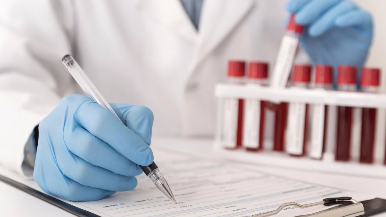 Doctor evaluando muestras de sangre en laboratorio