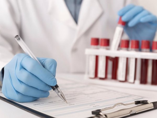 Doctor evaluando muestras de sangre en laboratorio