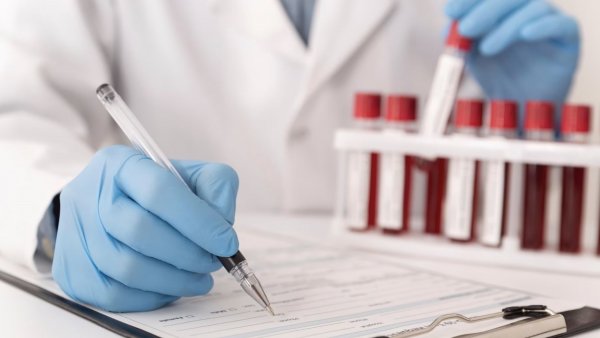 Doctor evaluando muestras de sangre en laboratorio