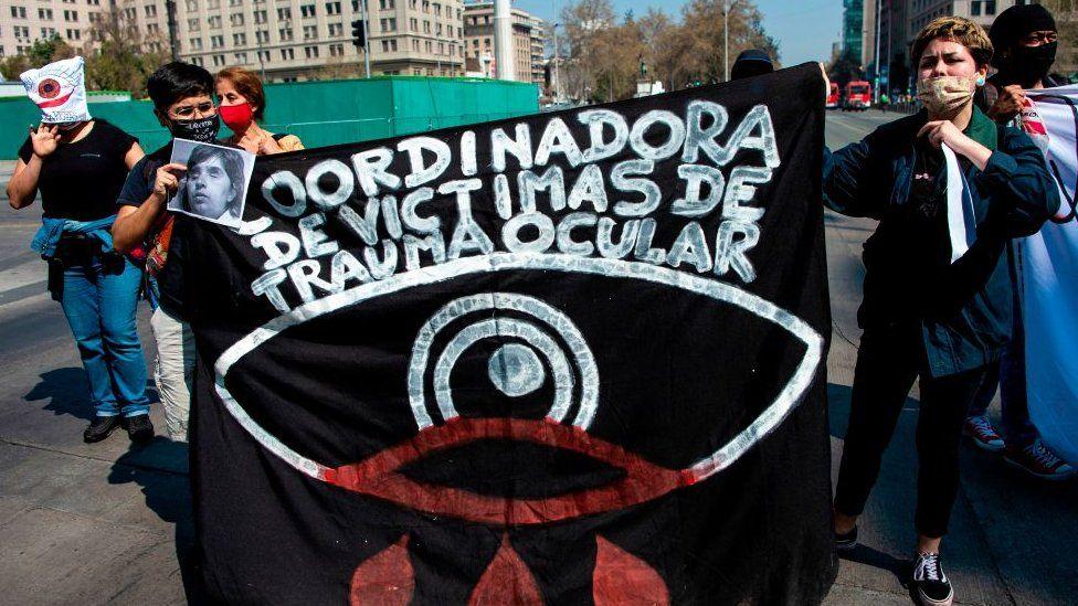 Varios grupos de apoyo han sido creados para ayudar a cientos de personas que sufrieron lesiones oculares durante las protestas.