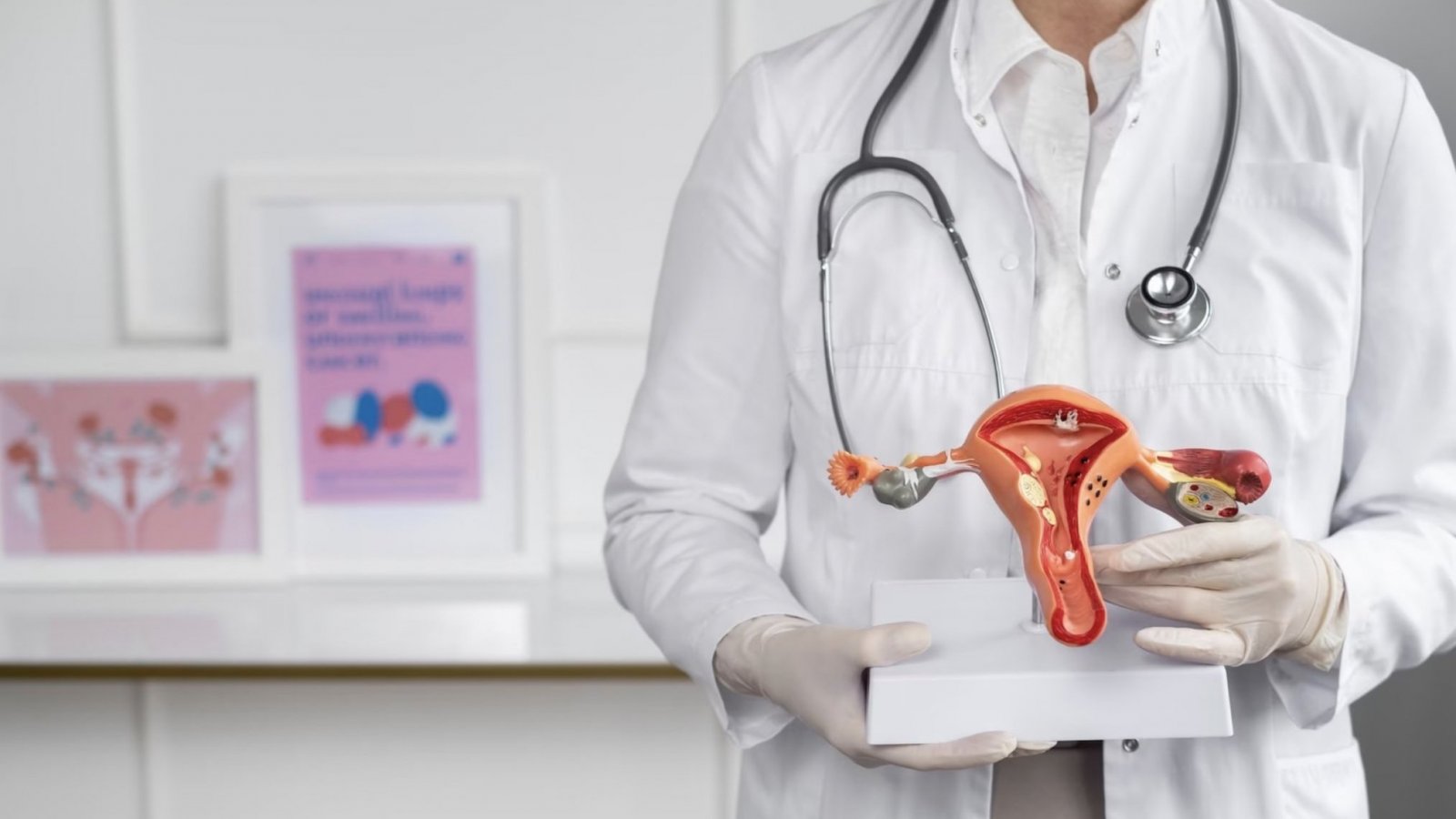 Doctora sosteniendo figura de útero. Trasplante de útero