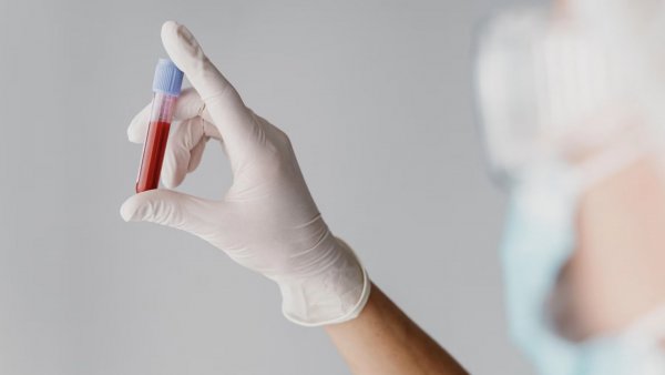 Muestra de sangre. Virus de Nipah