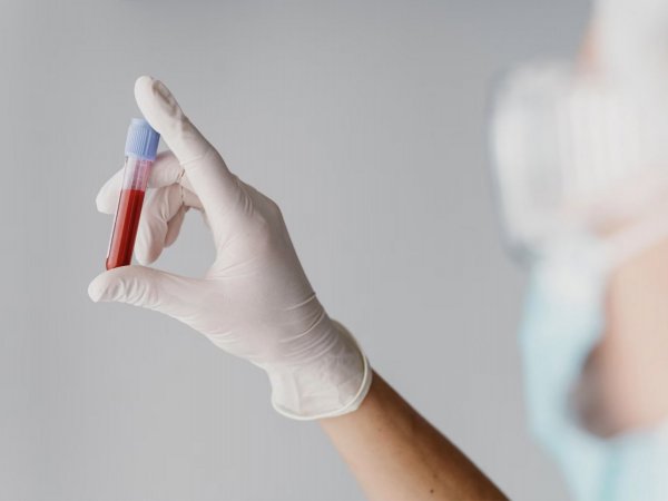 Muestra de sangre. Virus de Nipah