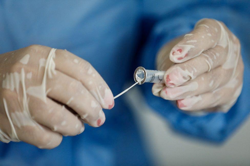 Una enfermera con una muestra de un paciente