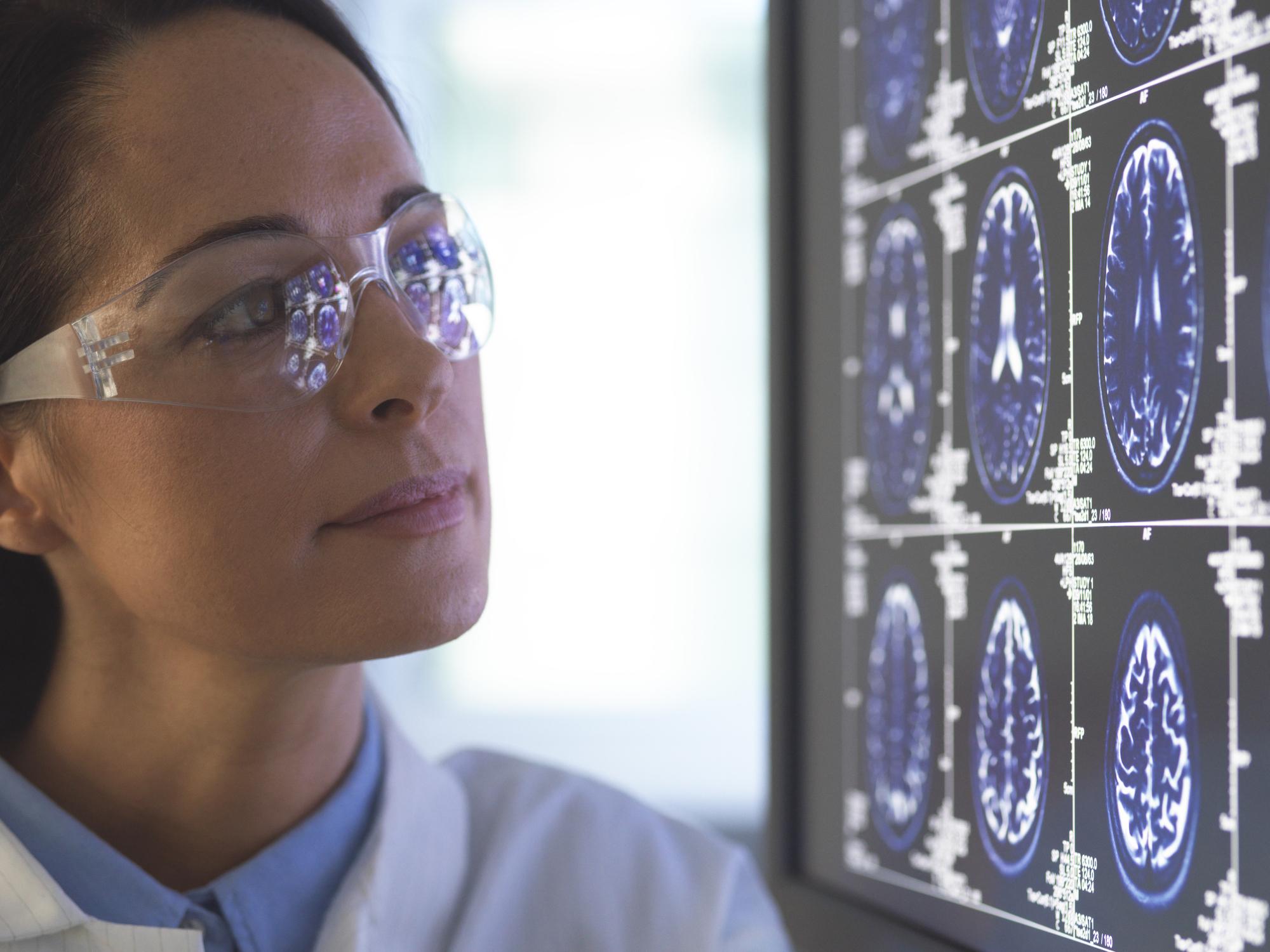 Doctora mira una pantalla con imágenes del cerebro.