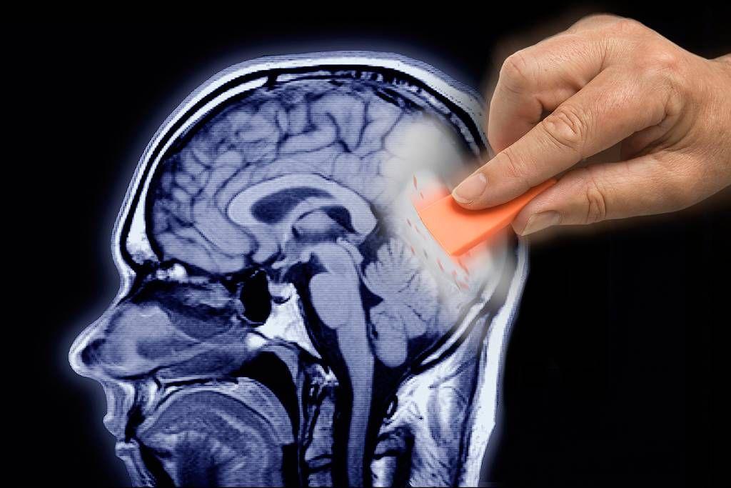 Mano borrándo parte del cerebro 