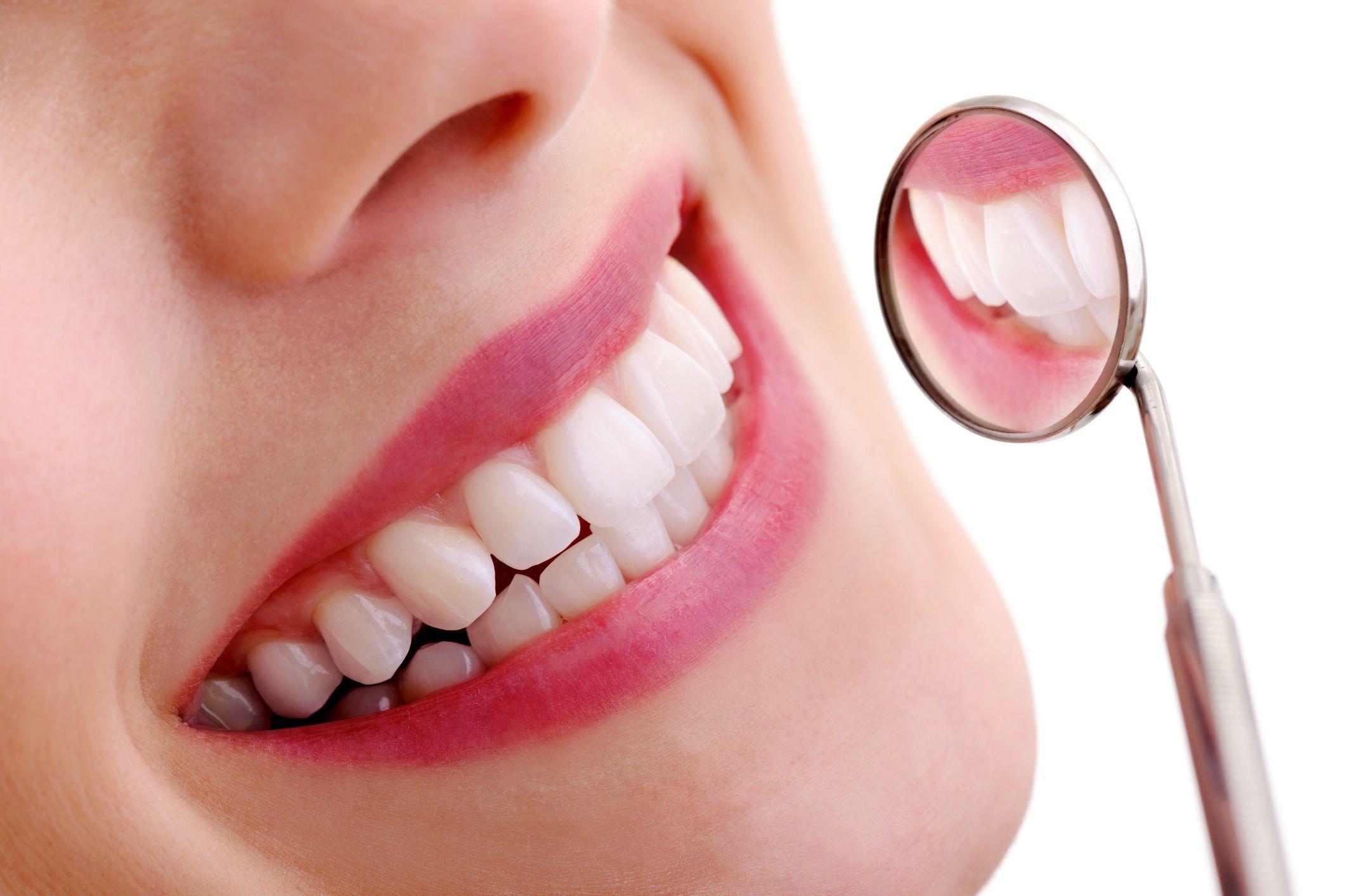 Una mujer sonriendo en el dentista
