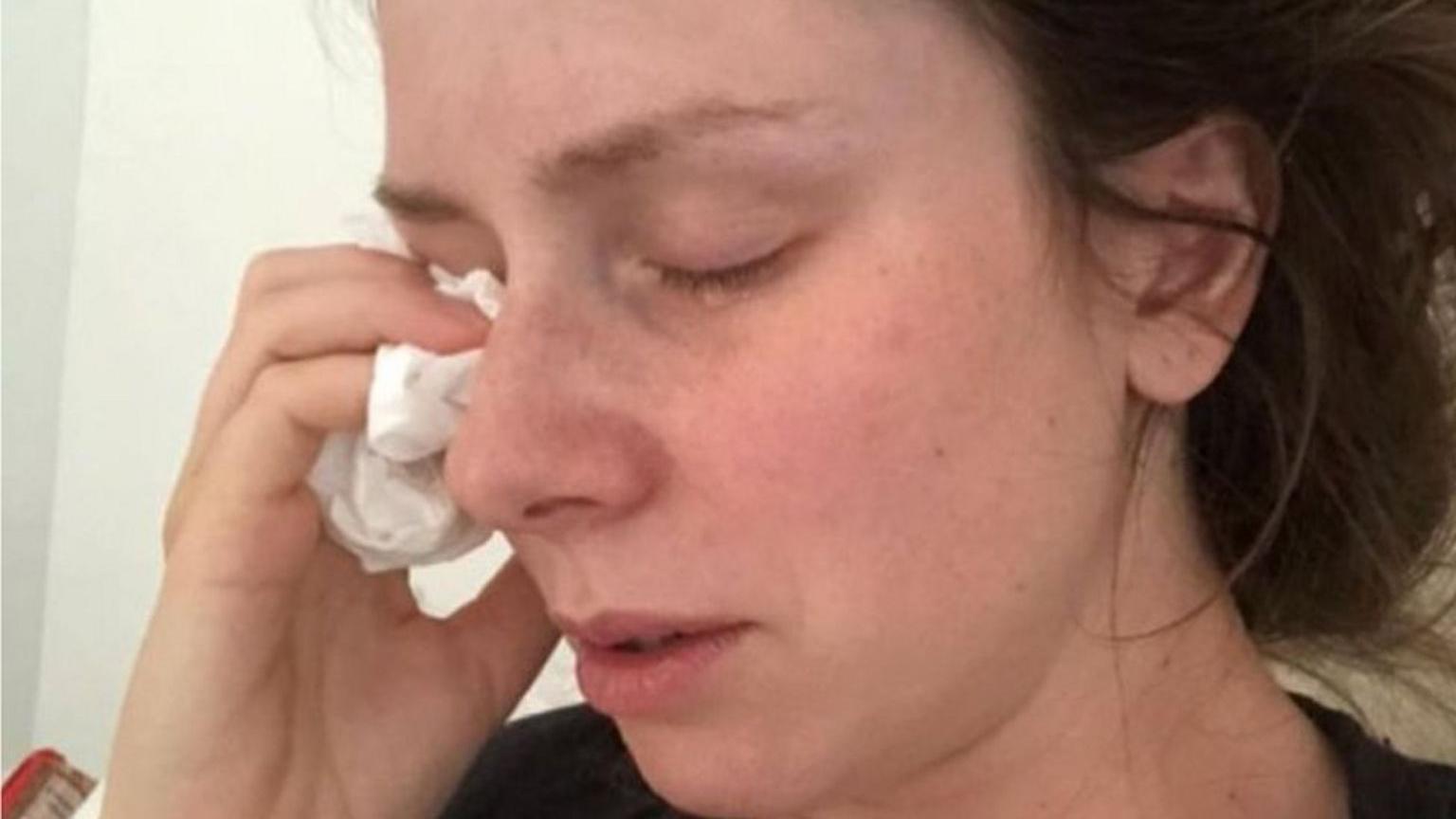 Susie Verrill no pudo salir de su habitación durante cinco meses durante sus embarazos debido a enfermedades constantes.