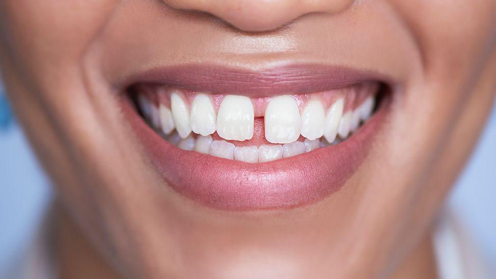 Sonrisa