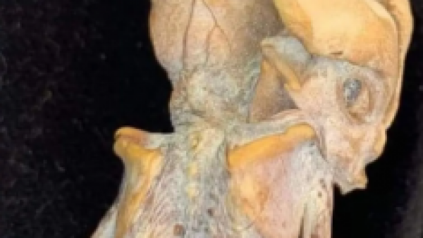 Descubren extraño feto momificado: terorías apuntan a un humano antiguo o un alienígena