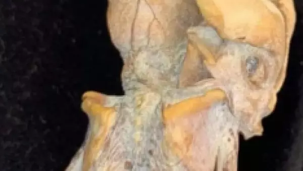 Descubren extraño feto momificado: terorías apuntan a un humano antiguo o un alienígena