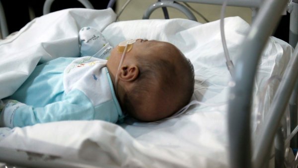 Nirsevimab contra el virus sincicial