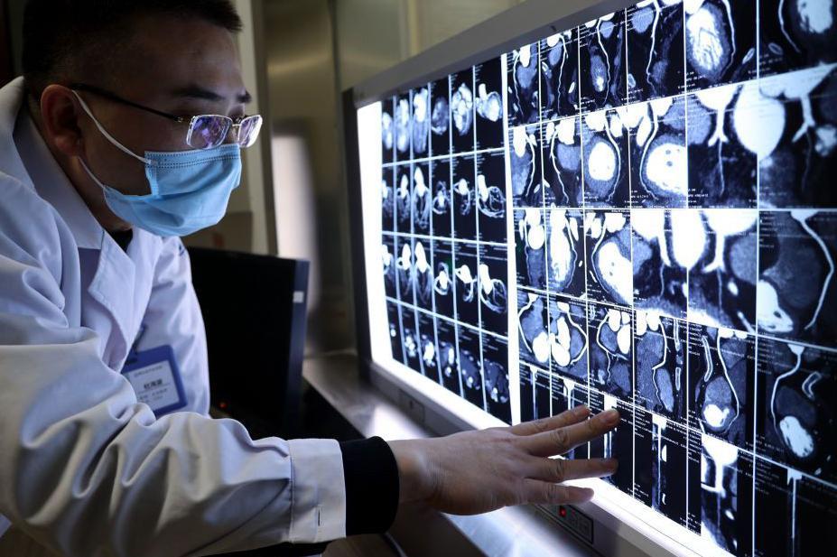 Un médico observa imagenes de una tomografía computada