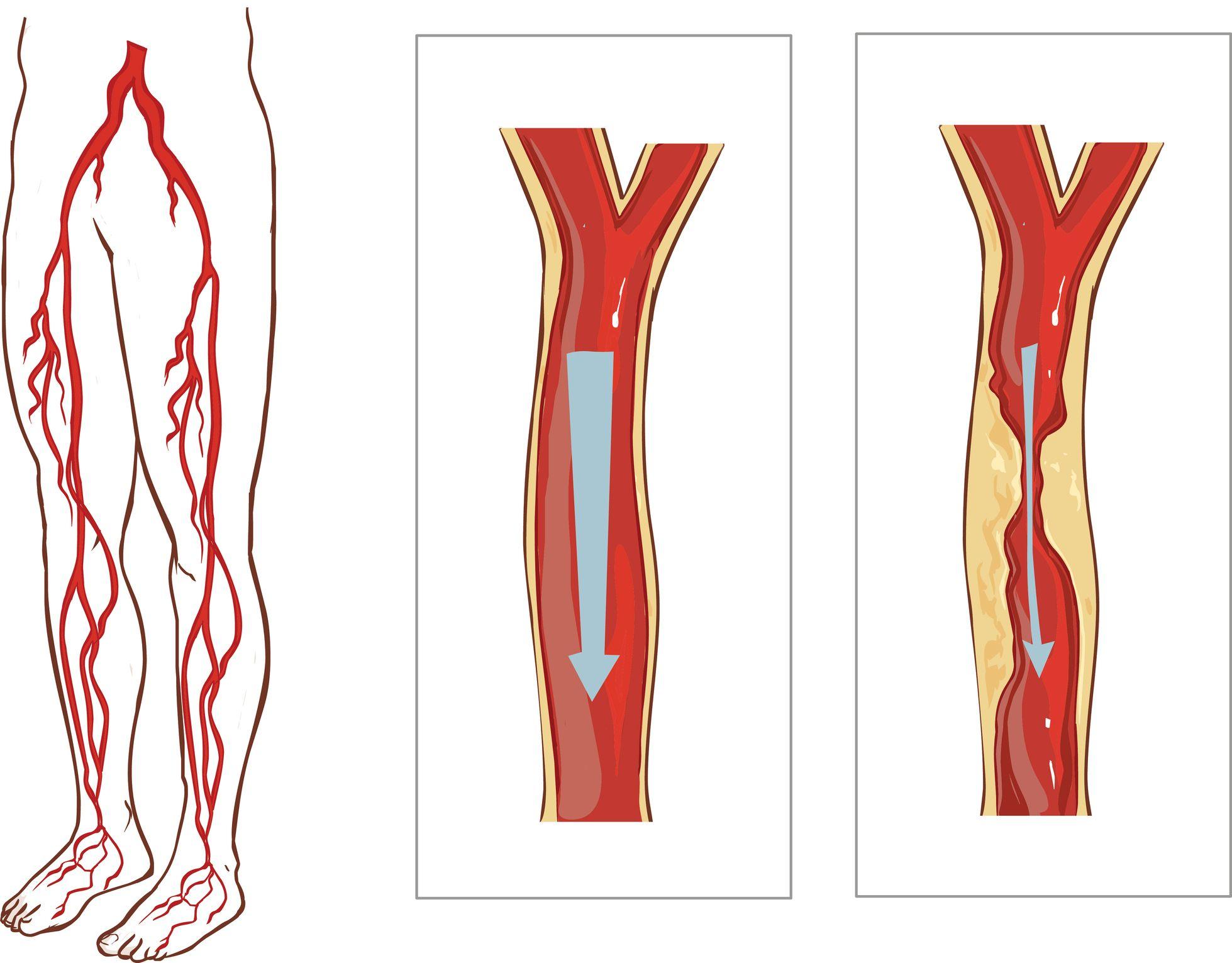 Las venas dentro del sóleo