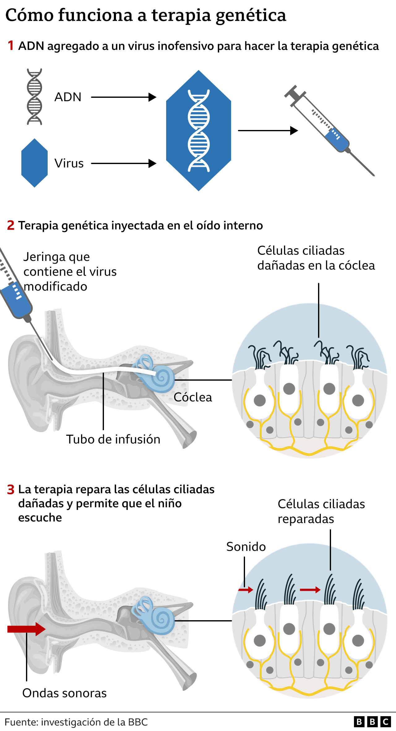 Gráfico