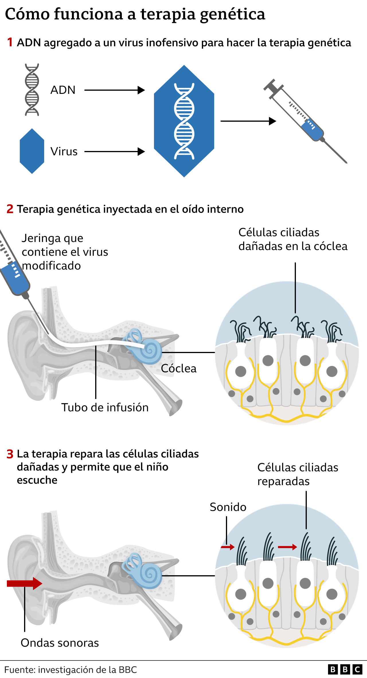 Gráfico 