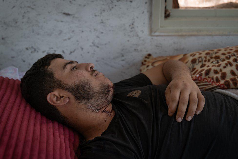 Yaqoub Nasan con una herida en el cuello