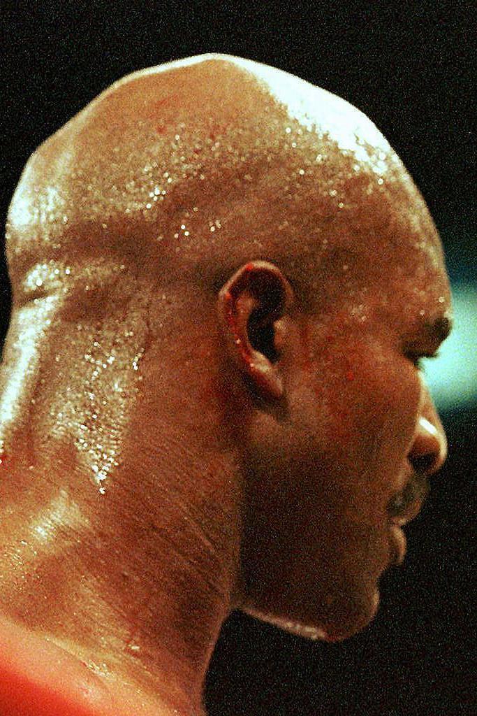 La oreja de Evander Holyfield sangrando