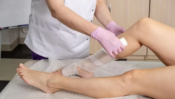 ¿Qué es el lipedema?