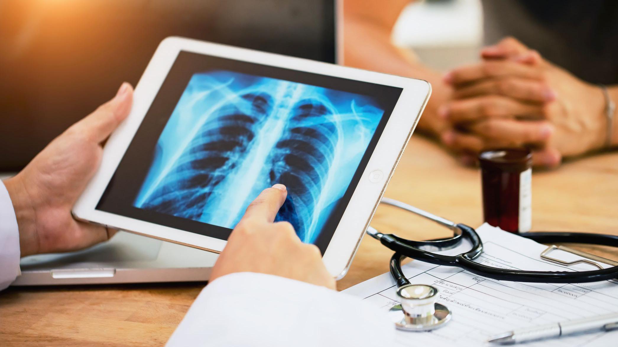 Médico mostrando resultados de radiografía a un paciente