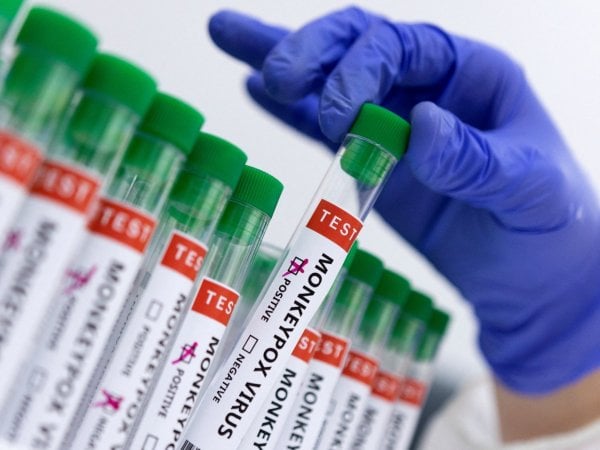 Muestras de viruela del mono. Mpox.