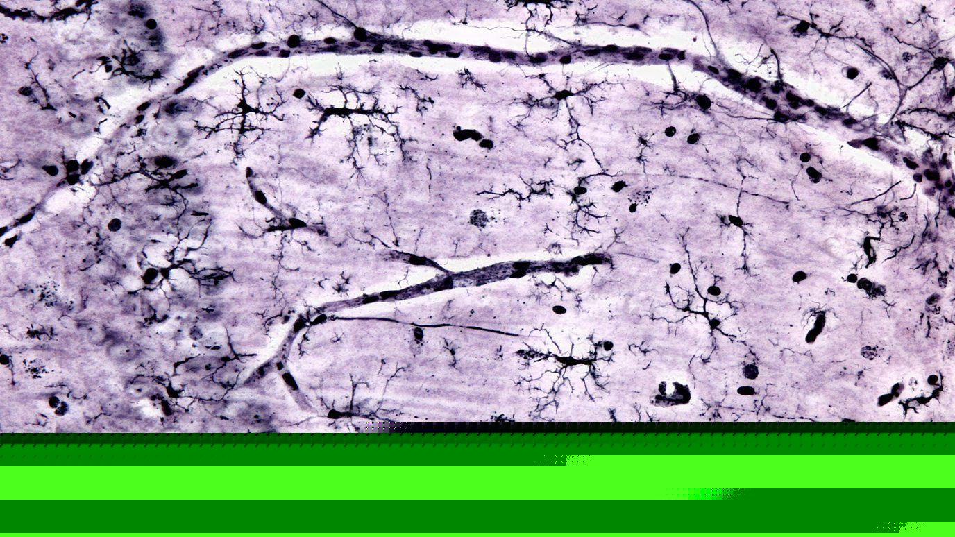 microglias 