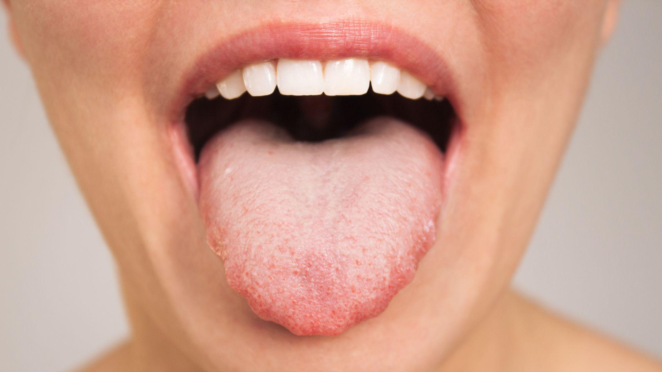 Lengua